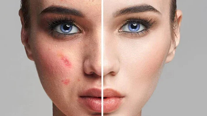 Air Cushion Foundation – LumiSkin™ for Flawless, Natural Coverage